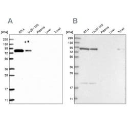CHML Antibody, Novus Biologicals CHML Antibody; Unconjugated; 100 &mu;L:Antibodies,